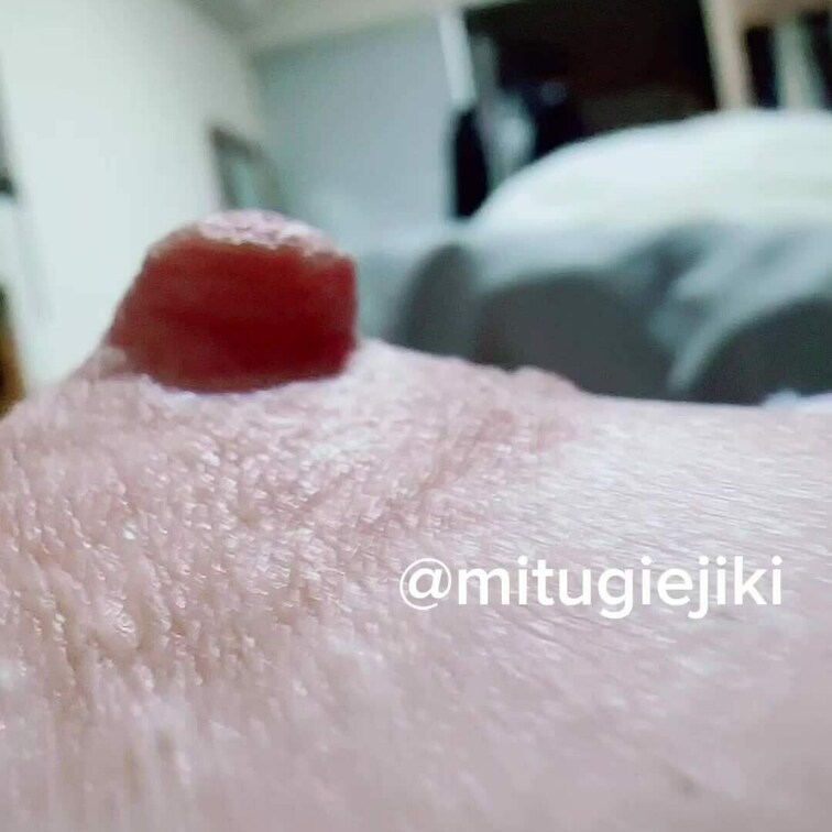 観察