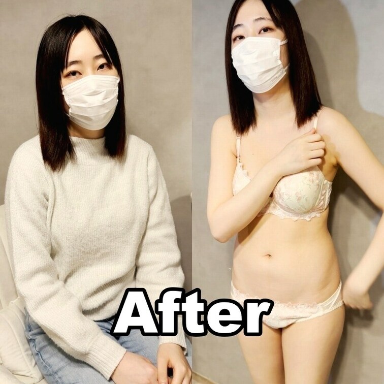 #26【SAYO 20歳】
今回は陥没している乳首とおっぱいの大きさでお悩みのSAYO様に、モニター体験のご協力をいた