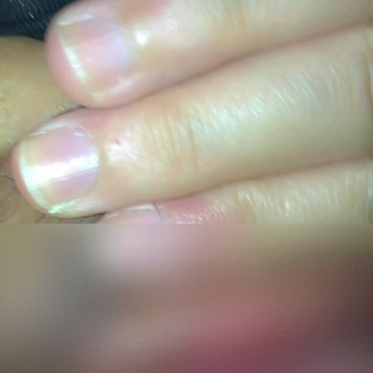 恥ずかしい〜💦😵
糸が⚠️💦