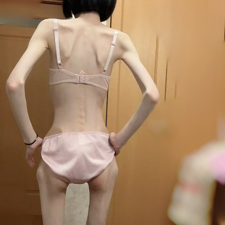 尾てい骨、床ずれて痛いことがあります( i ꒳ i )！

膝の周りがえぐれてるので、ポッキーみたいな真っ直ぐの棒み