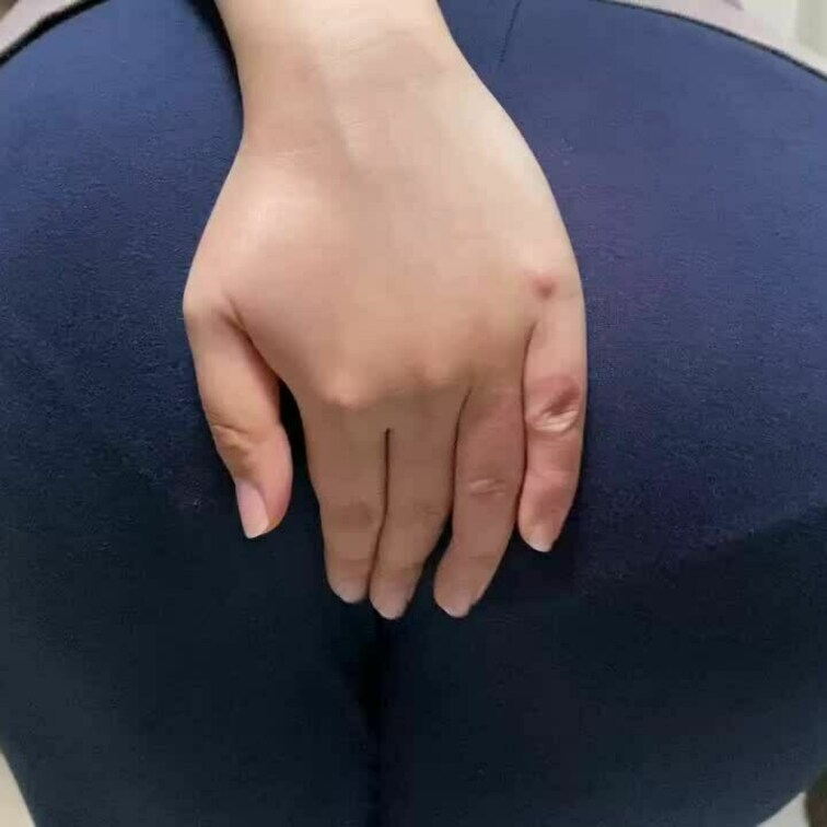 ぱかっ😳