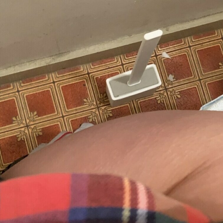 ［pee］便器さんの中見えます🧻⚠️
はちゃめちゃにおなかが痛いです😣
うう…🥲💦


You can see