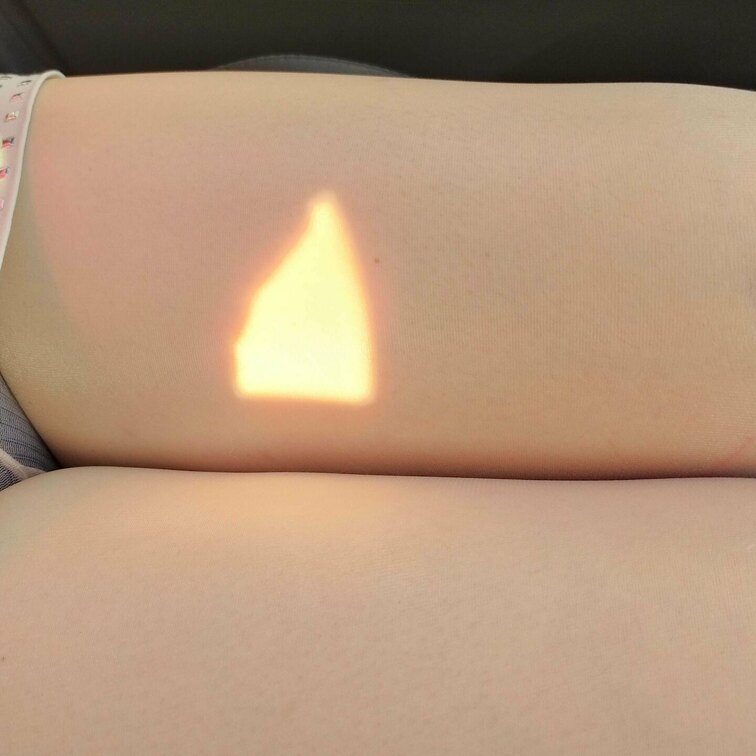 膝にアザが！
何処かにぶつけたのかな？