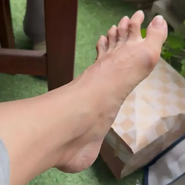 足指と血管。何の手入れもしてない足。素の素。
かさぶたとかついてます。