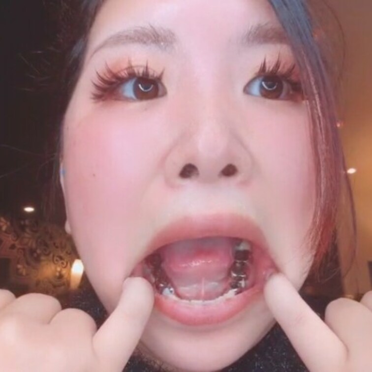 歯のシリーズ大人気だったので、また、撮影しました。銀歯のキラキラが凄いことに！よく見てね！