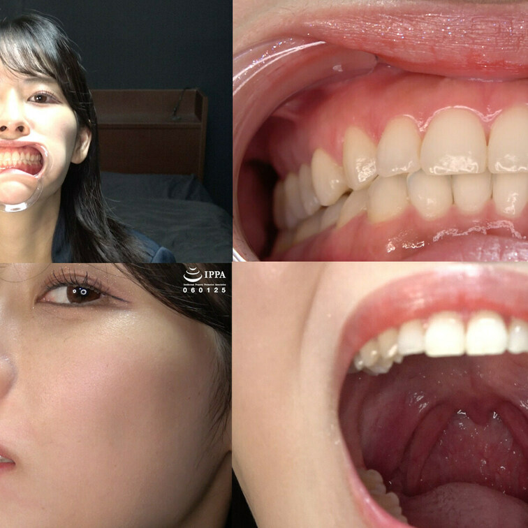 「【歯・口内】綺麗なお○○○さんの激レアな口内・歯観察！」わかしラボ WAKA-061祈山愛⑥ HD Ver.

綺