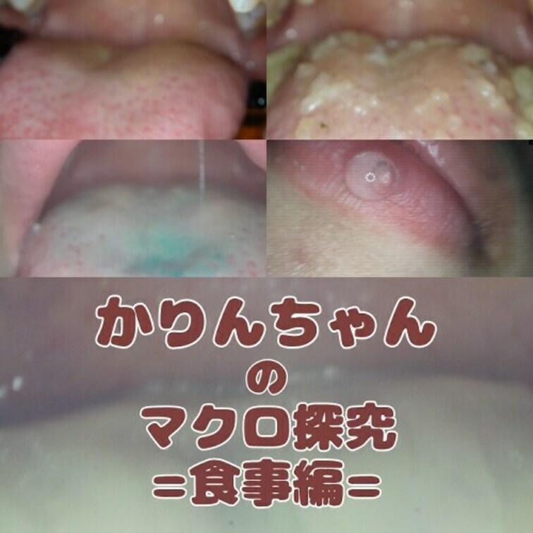 かりんちゃん=食事編=🍩

かりんちゃんの食事を接写いたしました！
お菓子が溶けていく様子・咀嚼されていく様子を
ドロドロになったおくちの中…お楽しみください。

00:40～　①食べ観察（チョコ）
03:05～　②食べ観察咀嚼（グミ）
06:10～　⓷食べ観察咀嚼（お菓子）
09:10～　④食べ観察（パチパチ）
11:25～　⑤息吐きかけ
13:50～　➅ちゅぱ観察(唇）
17:00～　⑦唾洗浄（唾垂らしスロー）

全⑦シーン収録!
※研修動画のため少し割り引いております。

舌
歯
喉
唾
口内
口腔
口臭
のどちんこ
内視鏡
uvula 
saliva
tongue
mouthcam 
endoscope (1/2)
