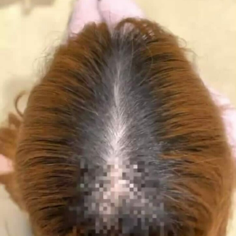 髪コキ❤️綺麗に手入れされた髪を使って、分け目にたっぷり精子を射精🥺💕想像以上に気持ちよくて…量がやばい。拭いたけどかな
