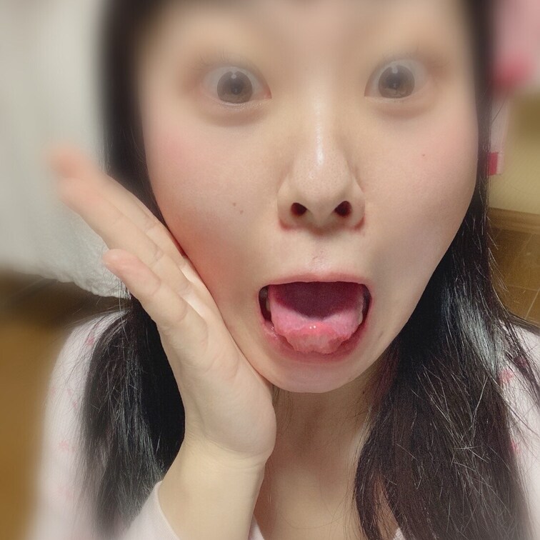 変態です。