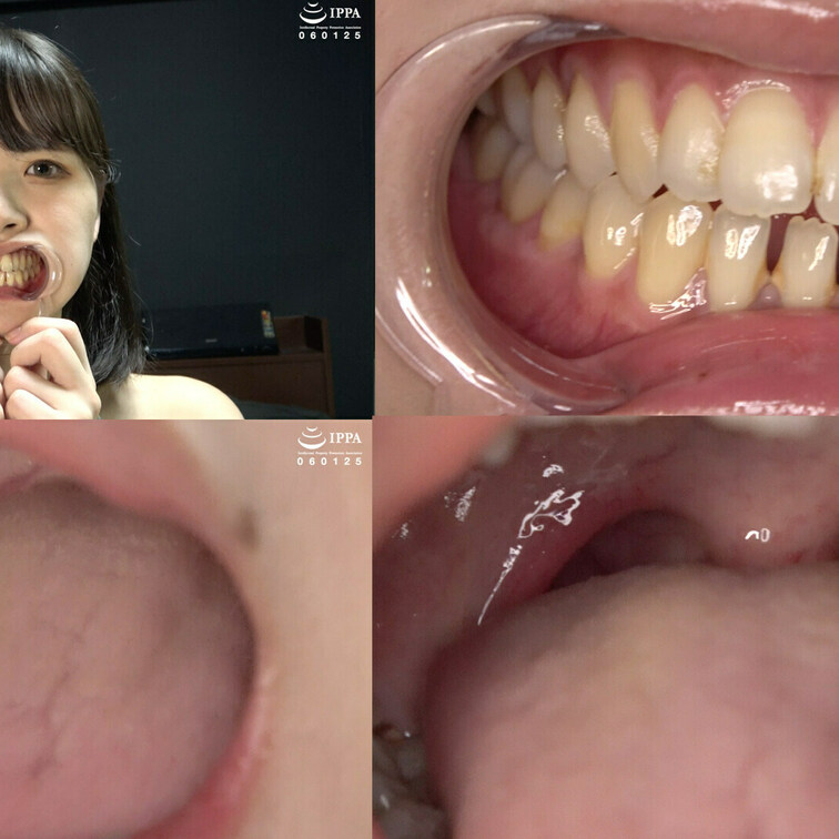 「【歯・口腔】人気モデル 乙羽あむチャンの超レアの歯・口内・舌ベロ観察！」乙羽あむ HD Ver.

人気モデル 乙