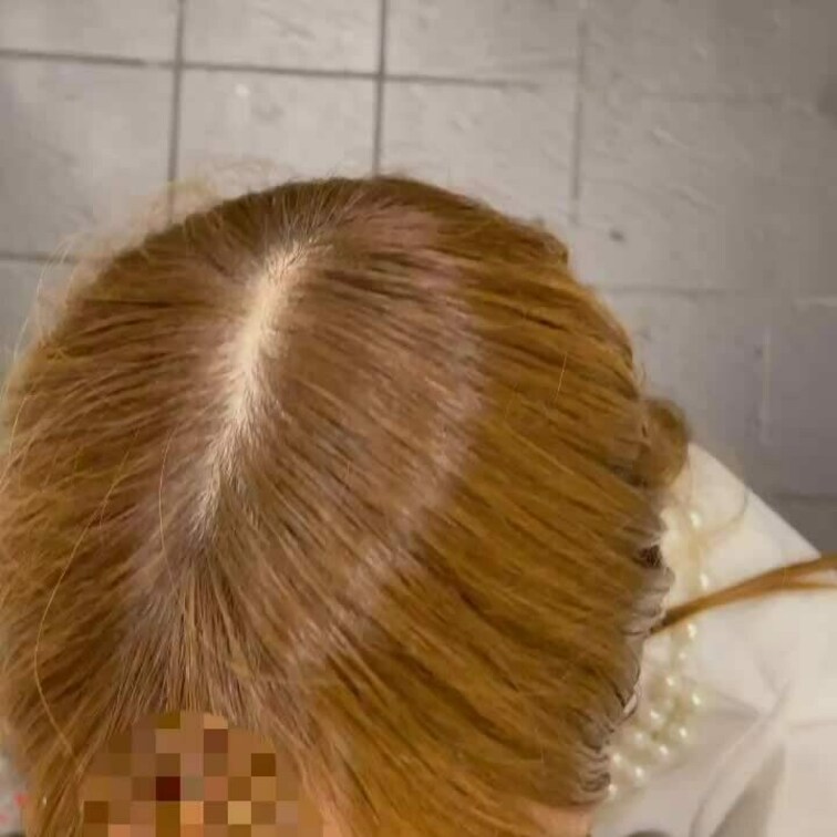 多目的フェラ