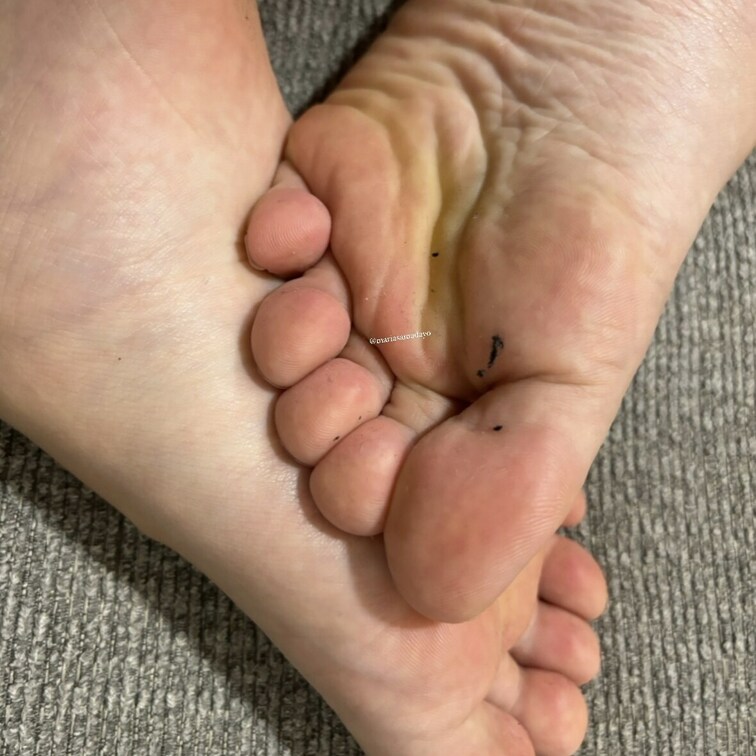 足汗で毛玉がくっついちゃった🦶🦶