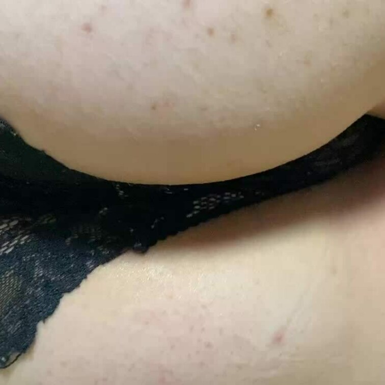 お尻もおならもばっちい🫠