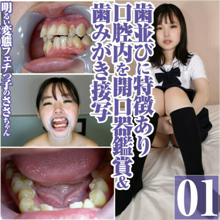明るい変態フェチっ子ささ歯並び特徴的な口腔内＆歯みがき開口器接写

明るい変態フェチっ子のささちゃんの
口腔内を開