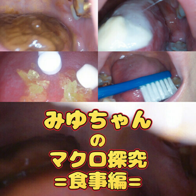 みゆちゃんのマクロ探究=食事編=
みゆちゃんの食事~歯磨き~唾までを接写いたしました!
お菓子が溶けていく様子、咀嚼され、嚥下されていく様子…
ドロドロになったおくちの中…お楽しみください。
※食べた後はちゃんと洗浄いたします。
01:00~ ①食べ撮影(チョコ)
04:10~ ②食べ観察(ホワイトチョコ)
07:20~ ⓷食べ観察咀嚼(グミ)
10:30~ ④食べ観察咀嚼(チップス)
13:45~ ⑤食べ観察(パチパチ)
16:45~ ➅息吐きかけ(口臭)
18:45~ ⑦歯磨き撮影
21:55~ ⑧唾洗浄(唾垂らしスロー)
EX マクロスロー撮影
34:15~ ⑨食べ観察(スロー撮影)
全⑨シーン収録 (1/2)