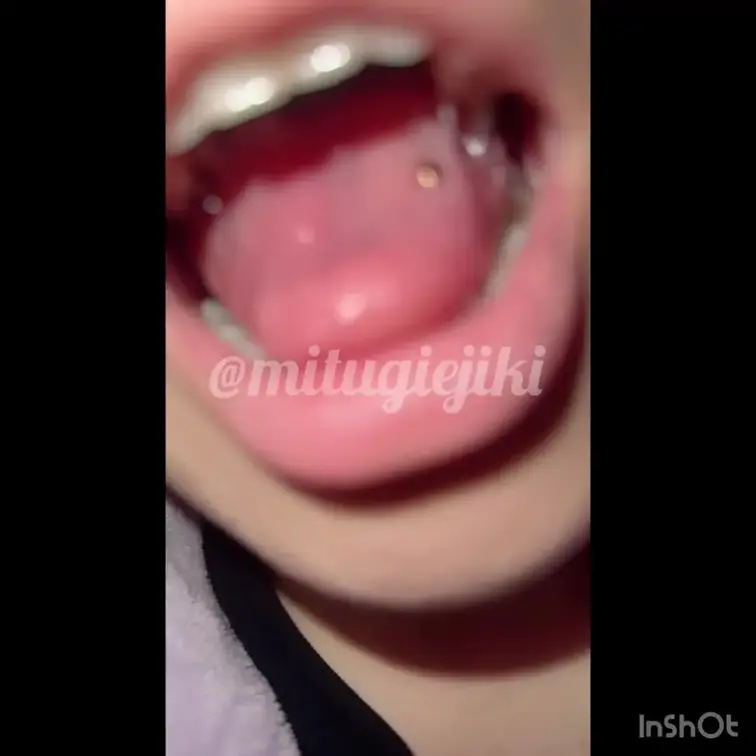口内検査