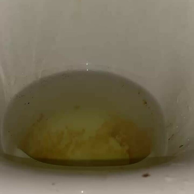 3日ぶりのうんち