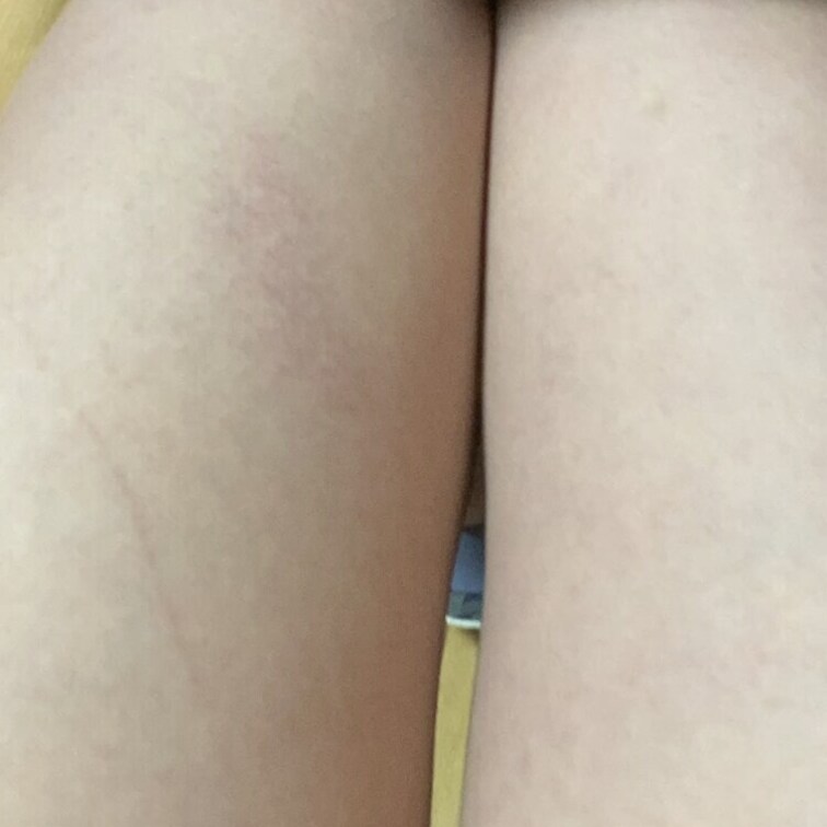 お風呂上がりのゆるめのうんちとオナラ、おしっこ🧻

せっかくお風呂入ったのに〜(´°̥̥̥ω°̥̥̥｀)
すんごく