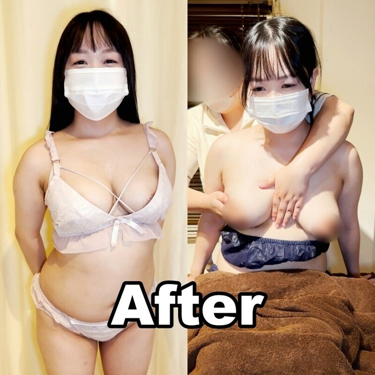 #30【RURI 24歳】
今回はおっぱいも含めた肌質がお悩みのRURI様に、モニター体験のご協力をいただきました👼